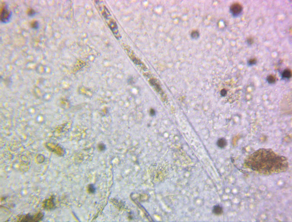 Vida del suelo vista al microscopio